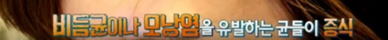 1년간 샴푸를 끊으면 생기는 머리의 변화 | 인스티즈