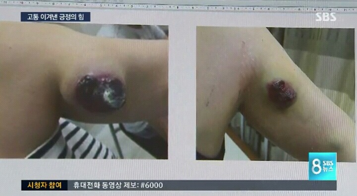 24세 말기암 환자의 놀라운 변화(feat. 이은결).jpg | 인스티즈
