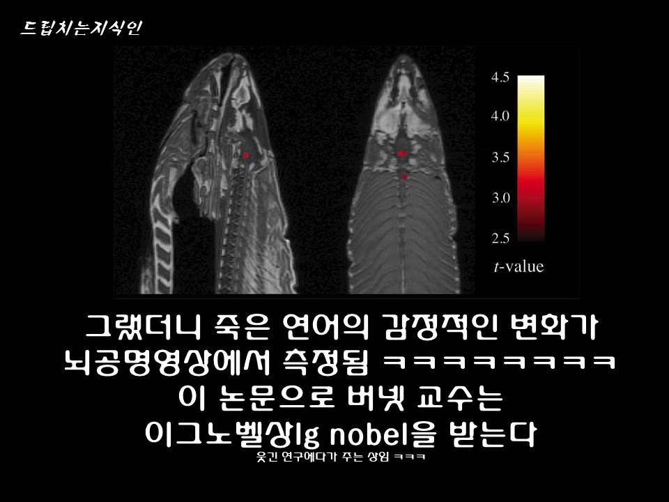  어마어마한 일들을 하고 있는 첨단 뇌공학 | 인스티즈
