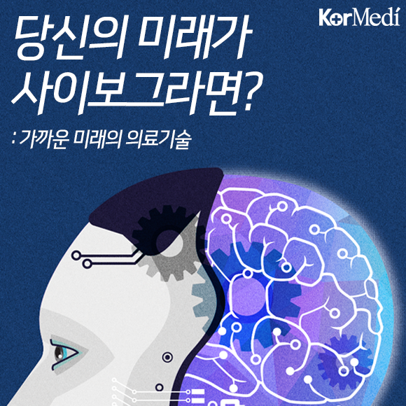 당신의 미래가 사이보그라면?: 미래 의료 신기술 | 인스티즈