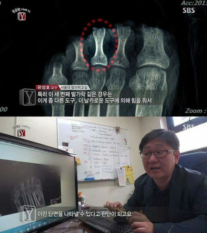 궁금한 이야기 Y 역대급 난제 | 인스티즈