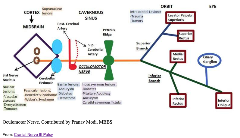 cranial nerve 3 palsy