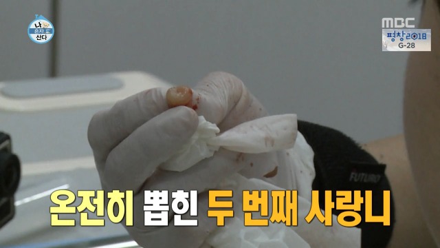 [나혼자산다] 너도나도 공감하는 공포의 사랑니 빼기 | 인스티즈